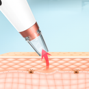 Removedor De Cravos Espinhas Cleaning Sugador Poros Acne Sucção Usb Recarregável