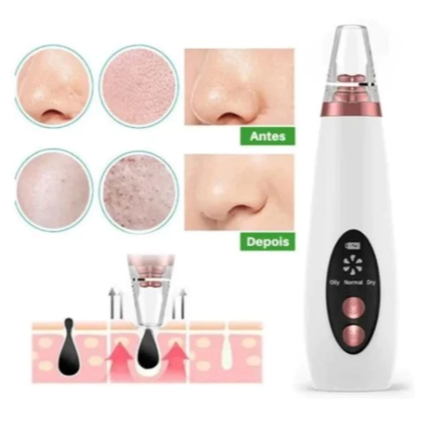 Removedor De Cravos Espinhas Cleaning Sugador Poros Acne Sucção Usb Recarregável